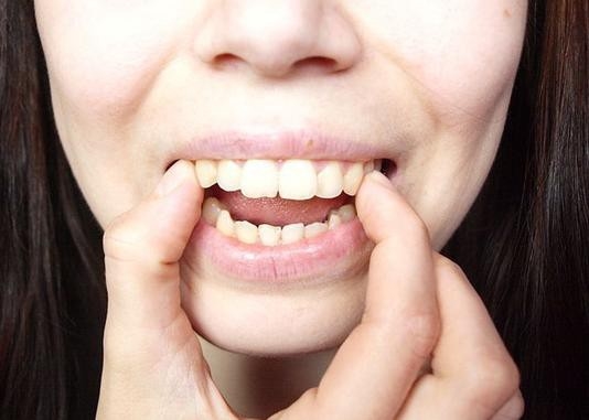Những nét tướng xấu mang đến vận số khó khăn, ít người dám kết giao
