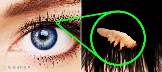 Demodex Demodex