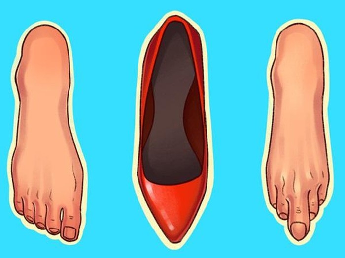 Những đôi giày phụ nữ mang thường xuyên nhưng chứa nhiều tác hại