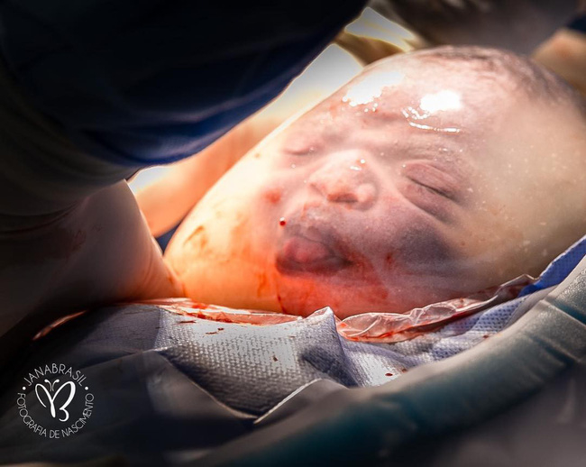 Em bé “nổi như cồn” vì vừa nằm trong túi ối vừa làm trò, hết chu mỏ đến thè lưỡi trêu chọc mọi người - Ảnh 5. Em bé “nổi như cồn” vì vừa nằm trong túi ối vừa làm trò, hết chu mỏ đến thè lưỡi trêu chọc mọi người - Ảnh 5.