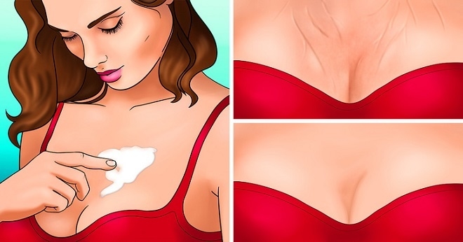 Những cách xóa nếp nhăn vùng ngực khiến chị em tự tin