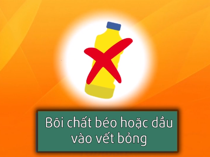 Những cách xử lí kịp thời khi bé bị bỏng mà ba mẹ cần khắc cốt ghi tâm Những cách xử lí kịp thời khi bé bị bỏng mà ba mẹ cần khắc cốt ghi tâm