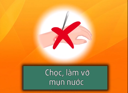 Những cách xử lí kịp thời khi bé bị bỏng mà ba mẹ cần khắc cốt ghi tâm Những cách xử lí kịp thời khi bé bị bỏng mà ba mẹ cần khắc cốt ghi tâm
