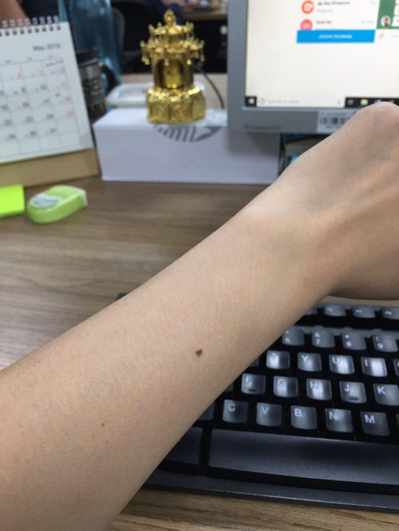 Rất nhiều người có thứ này ở cùng vị trí trên cơ thể, kiểm tra ngay xem mình có thuộc số đông hay không! - Ảnh 9. Rất nhiều người có thứ này ở cùng vị trí trên cơ thể, kiểm tra ngay xem mình có thuộc số đông hay không! - Ảnh 9.