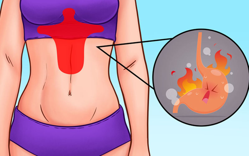 bắt bệnh qua các vị trí đau bụng hình 2 bat benh qua cac vi tri dau bung hinh 2