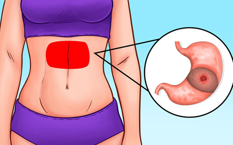 bắt bệnh qua các vị trí đau bụng hình 3 bat benh qua cac vi tri dau bung hinh 3
