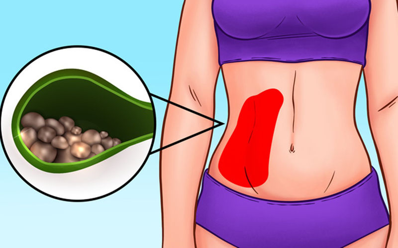 bắt bệnh qua các vị trí đau bụng hình 8 bat benh qua cac vi tri dau bung hinh 8