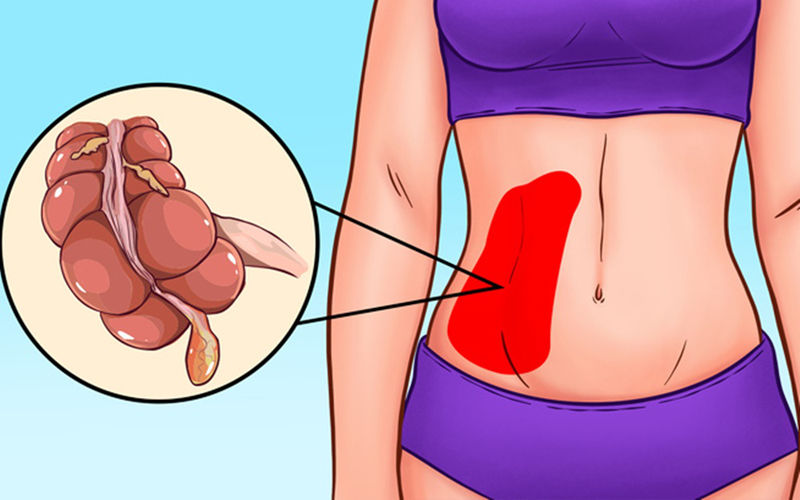 bắt bệnh qua các vị trí đau bụng hình 9 bat benh qua cac vi tri dau bung hinh 9