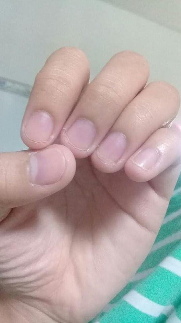Có một kiểu người móng tay chẳng bao giờ nhú lên được vì cứ rảnh là ngồi cắn - Ảnh 7. Có một kiểu người móng tay chẳng bao giờ nhú lên được vì cứ rảnh là ngồi cắn - Ảnh 7.