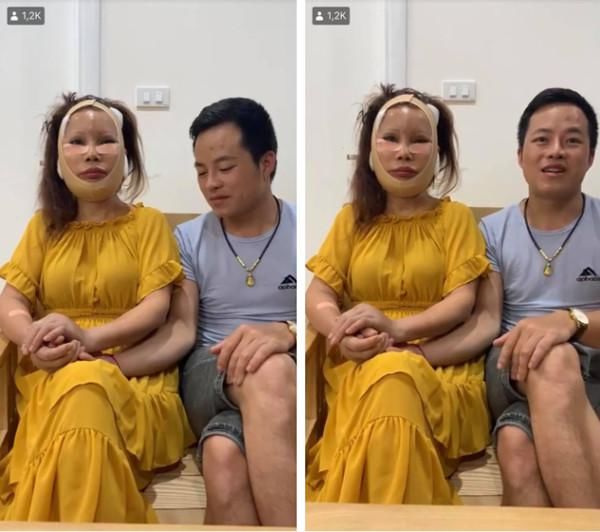 Cô dâu 62 tuổi tự tin livestream với gương mặt sưng phù hậu thẩm mỹ