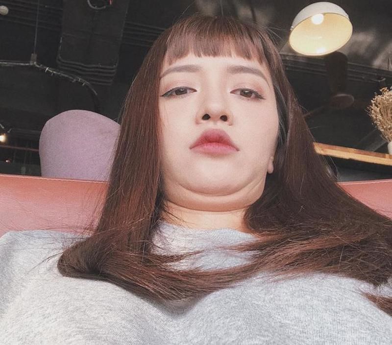 Sao Việt và nỗi ánh ảnh mang tên nọng cằm: Do thói quen tích mỡ