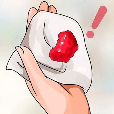 Xem qua màu sắc kinh nguyệt báo động tình trạng sức khỏe, chị em nên lưu tâm