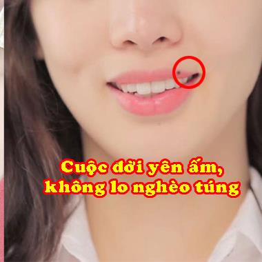 Những nốt ruồi “đại phú đại quý” trên cơ thể, chị em nhất định không được tẩy xóa
