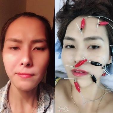Cô gái và câu chuyện liệt dây thần kinh số 7, méo cả miệng vì nằm điều hòa gây sốt CĐM
