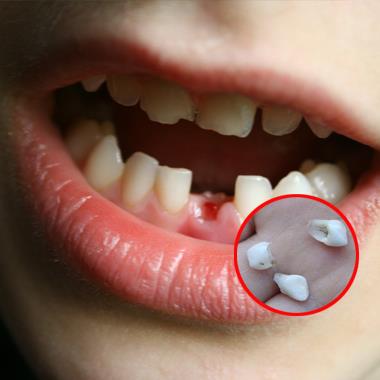 Bố mẹ đừng bao giờ vứt đi chiếc răng sữa của con, vì nó có thể giúp cứu mạng con bạn sau này đấy!