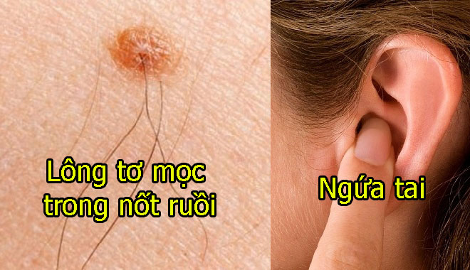 Những điềm lạ xuất hiện trên cơ thể chứng tỏ bạn sắp gặp vận may, phát tài phát lộc Những điềm lạ xuất hiện trên cơ thể chứng tỏ bạn sắp gặp vận may, phát tài phát lộc
