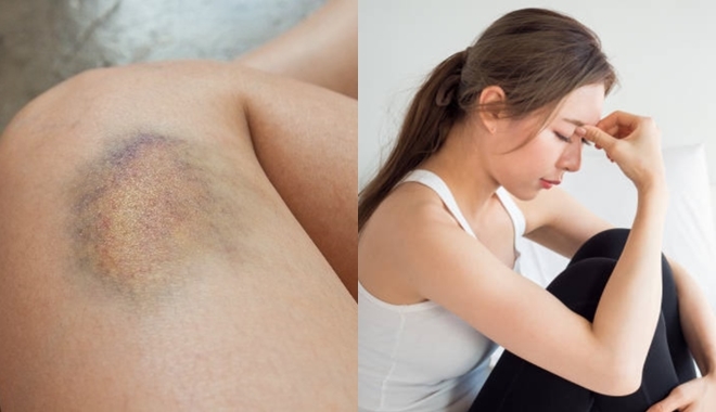 Đừng lơ là, đây là những dấu hiệu cảnh báo cơ thể bạn đang lão hóa sớm, nhất là cái thứ 4 Đừng lơ là, đây là những dấu hiệu cảnh báo cơ thể bạn đang lão hóa sớm, nhất là cái thứ 4