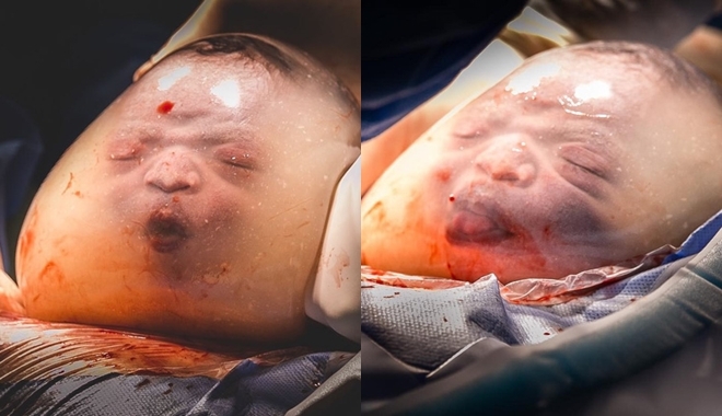 Vẫn còn trong túi ối em bé đã làm trò "chào thế giới", hết chu mỏ đến thè lưỡi cực yêu Vẫn còn trong túi ối em bé đã làm trò "chào thế giới", hết chu mỏ đến thè lưỡi cực yêu
