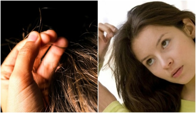 Cảnh báo: Thường xuyên bứt tóc, nhổ lông mi coi chừng là dấu hiệu bệnh tâm thần Cảnh báo: Thường xuyên bứt tóc, nhổ lông mi coi chừng là dấu hiệu bệnh tâm thần