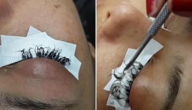 Rợn người với những hình ảnh nối mi hỏng: Bạn còn dám đi nối mi không? Rợn người với những hình ảnh nối mi hỏng: Bạn còn dám đi nối mi không?
