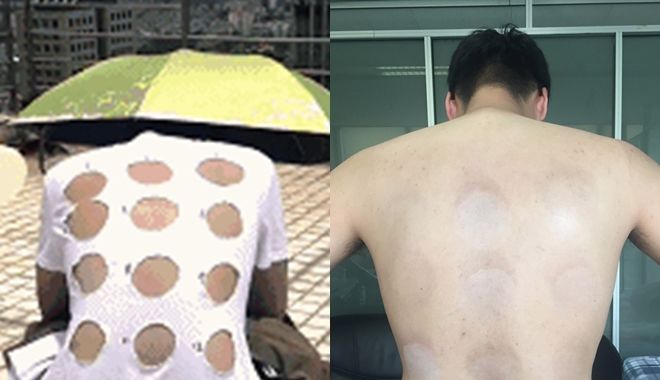 Chàng trai phơi mình dưới 34 độ C để thử 12 kem chống nắng và cái kết không thể thật hơn! Chàng trai phơi mình dưới 34 độ C để thử 12 kem chống nắng và cái kết không thể thật hơn!