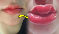 Cô gái trẻ chia sẻ ảnh trước và sau khi phun môi: Nhiều người trấn an
