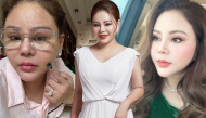 Lê Giang tung ảnh cam thường trước tin đồn xuống sắc do “dao kéo”