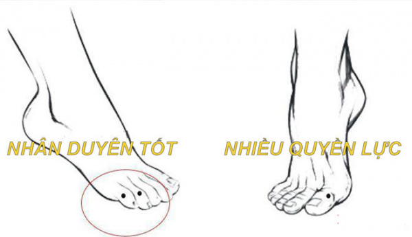 5 vị trí nốt ruồi ở chân là điềm báo mang đến nhiều phú quý 