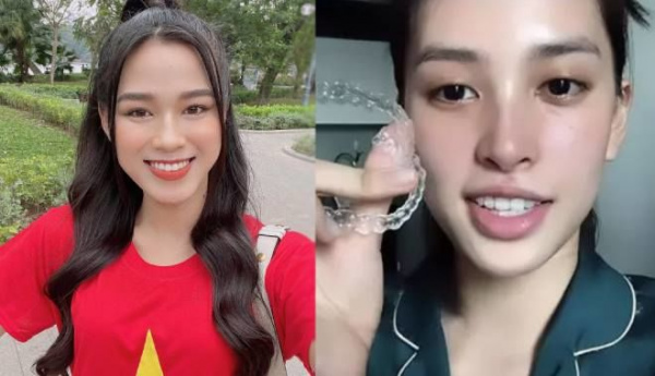 Nối gót Đỗ Thị Hà, Trần Tiểu Vy cũng chỉnh nhẹ điểm 