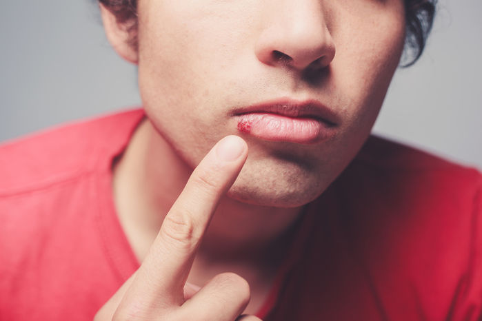 14 dấu hiệu bất thường trên khuôn mặt báo hiệu sức khoẻ của bạn đang có vấn đề