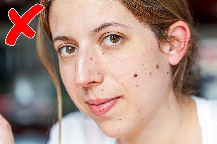 14 dấu hiệu bất thường trên khuôn mặt báo hiệu sức khoẻ của bạn đang có vấn đề