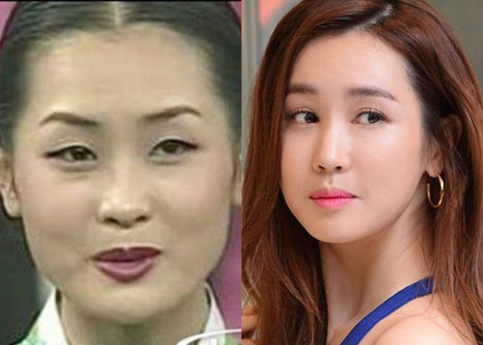 Sao Hàn lên đời nhan sắc nhờ hô biến mắt 1 mí thành 2 mí to tròn