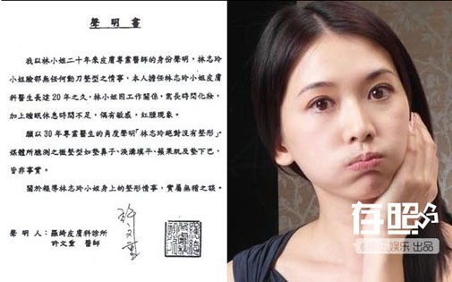 Đủ kiểu chứng minh không phẫu thuật thẩm mỹ của các người đẹp Hoa ngữ
