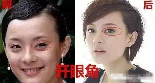 Mỹ nhân thừa nhận thẩm mỹ đẹp tự nhiên, kẻ chối bỏ lại để lộ di chứng