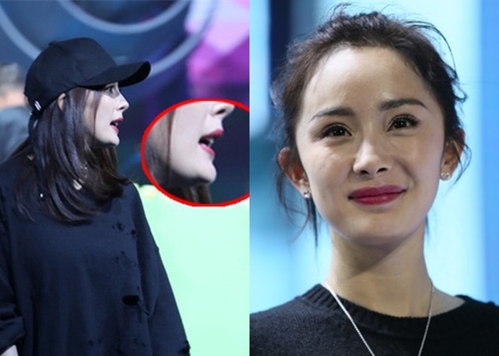 Mỹ nhân thừa nhận thẩm mỹ đẹp tự nhiên, kẻ chối bỏ lại để lộ di chứng