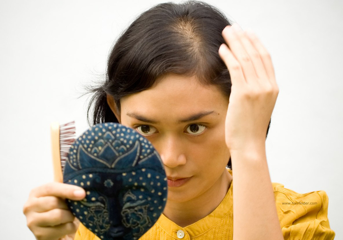 Những bất thường ở mái tóc cảnh báo sức khỏe có vấn đề
