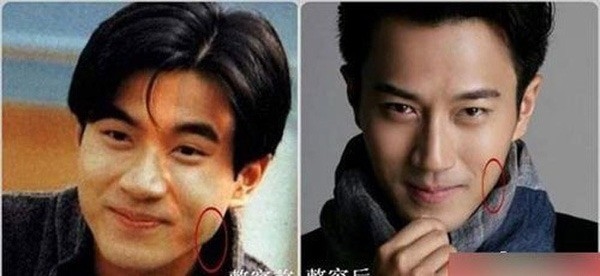 Loạt nam thần đua nhau dao kéo: Người ngày càng đẹp, kẻ lại xuống sắc