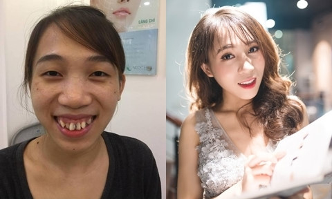 Những siêu phẩm dao kéo Việt gây xôn xao cộng đồng mạng năm 2018