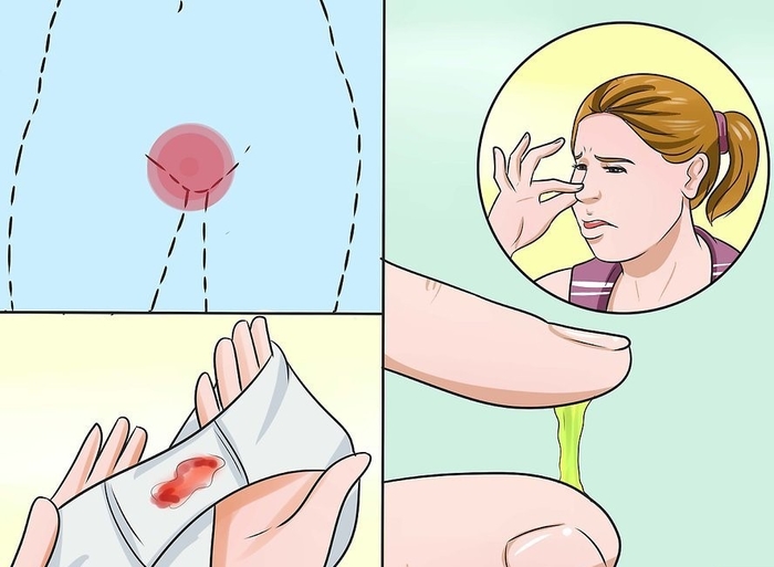 Chuyên gia phụ khoa cảnh báo 5 dấu hiệu vô sinh phổ biến ở phụ nữ