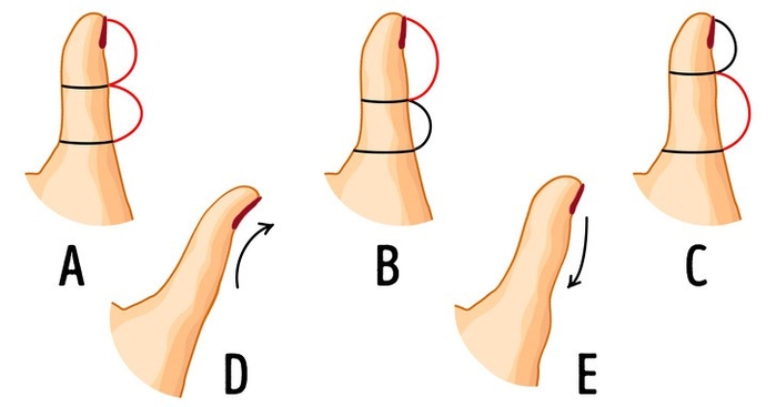 Bói ngay tính cách tiềm ẩn của bản thân qua hình dạng ngón tay cái