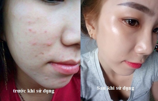 Đừng tưởng chỉ có mỗi vitamin C, vẫn có một loại vitamin dưỡng da khác
