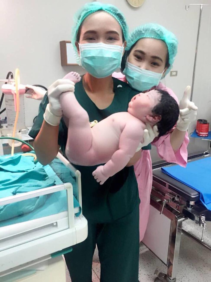 Ngắm vẻ đáng yêu, bụ bẫm của em bé sơ sinh đẻ thường nặng tới 5,2kg