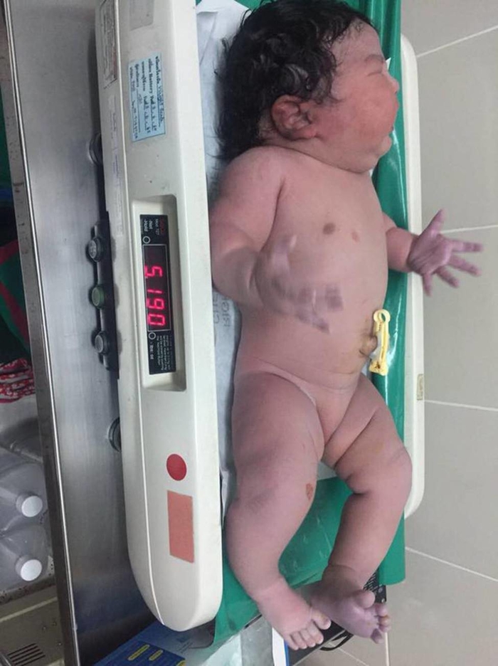Ngắm vẻ đáng yêu, bụ bẫm của em bé sơ sinh đẻ thường nặng tới 5,2kg