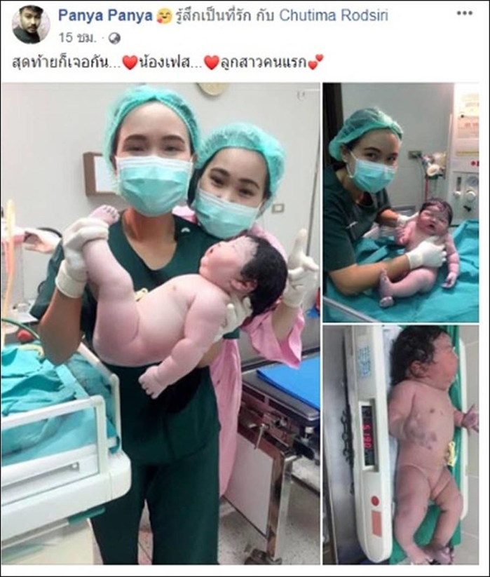 Ngắm vẻ đáng yêu, bụ bẫm của em bé sơ sinh đẻ thường nặng tới 5,2kg