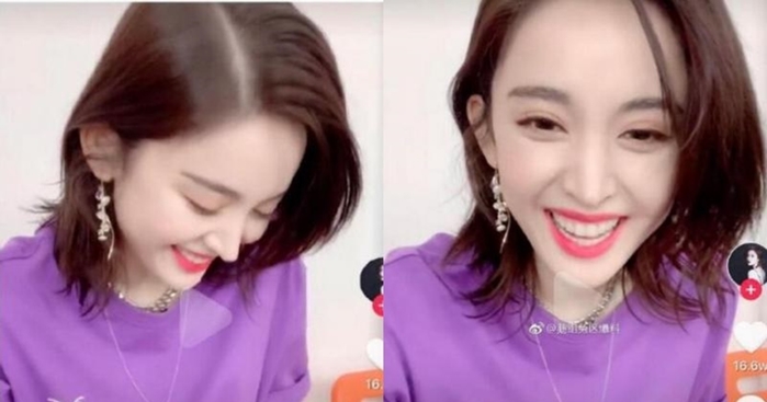 Cổ Lực Na Trát dính nghi vấn phẫu thuật thẫm mỹ hỏng