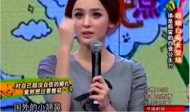 Cổ Lực Na Trát dính nghi vấn phẫu thuật thẫm mỹ hỏng