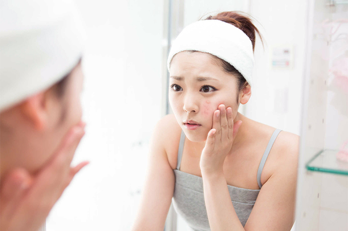 Nếu làn da có dấu hiệu này, bạn cần tạm biệt ngay và luôn lọ kem dưỡng