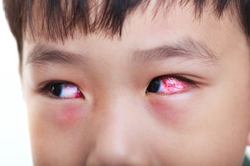 Những mẹo dân gian chữa được bách bệnh, ai cũng cần nhớ lúc khẩn cấp