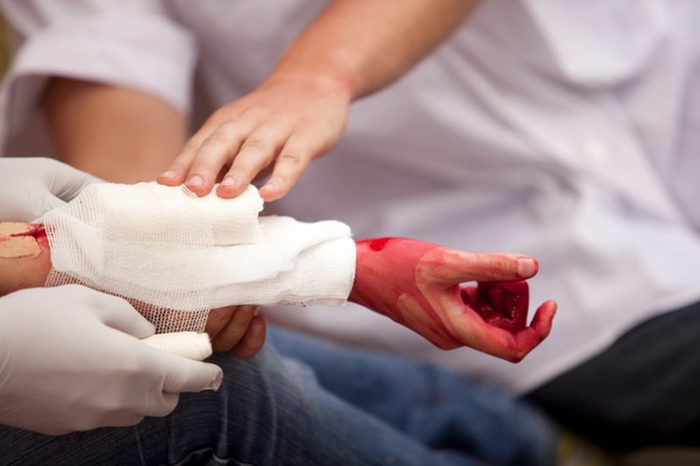 Cách cấp cứu khi bị đứt lìa chân, tay ai cũng nên biết khi khẩn cấp