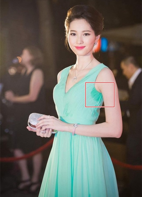 Sao gặp sự cố kém duyên ở vùng cánh khiến ai thấy cũng gượng dùm